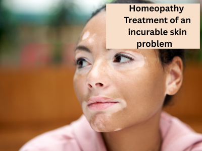 Dr Guneet homeopathy