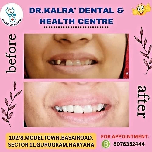 Dr. Kalra's Dental Centre
