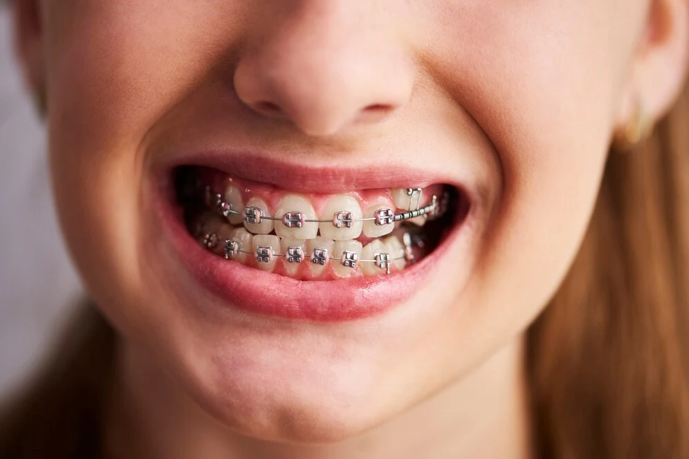 Prof. DR. VINAYAK; SMILESSENCE-THE SPECIALIST DENTAL CENTRE
