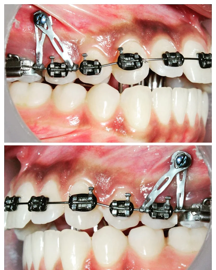 Symmetry Dental