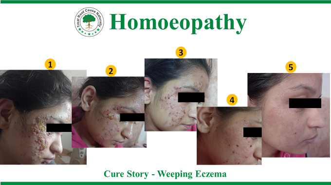 Dr Rupam Sharma Homoeopathy