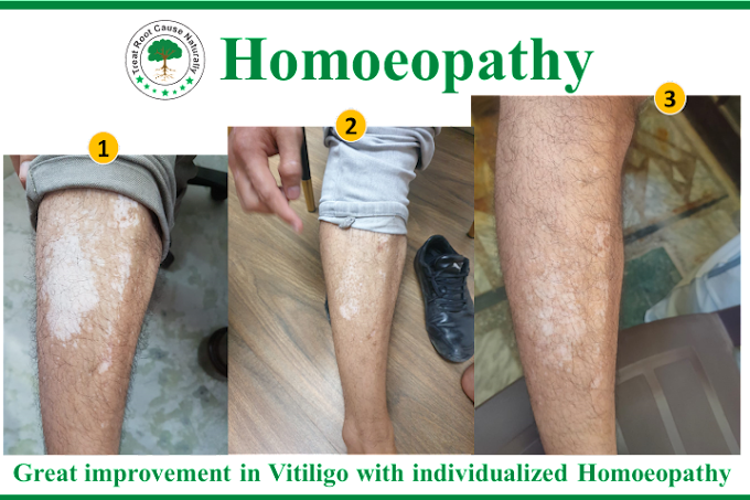 Dr Rupam Sharma Homoeopathy