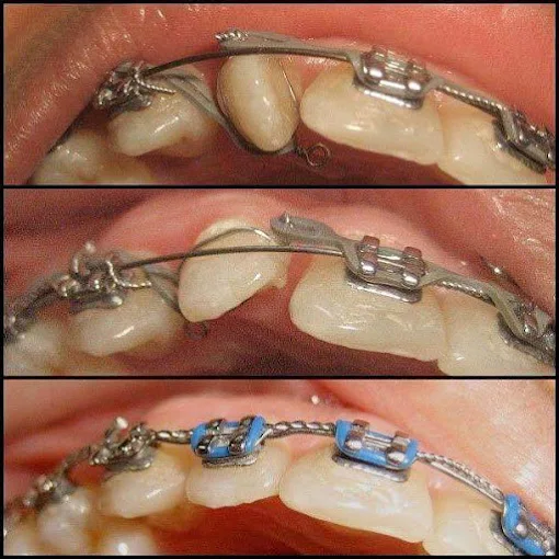 YOUR DENTIST