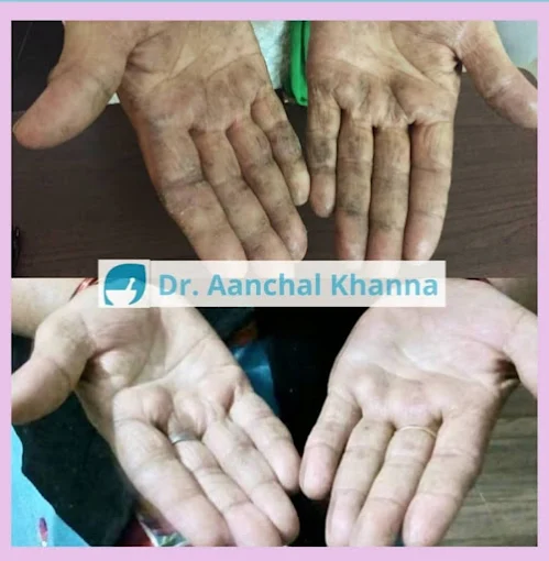 Dr Aanchal Khanna Homeopathy