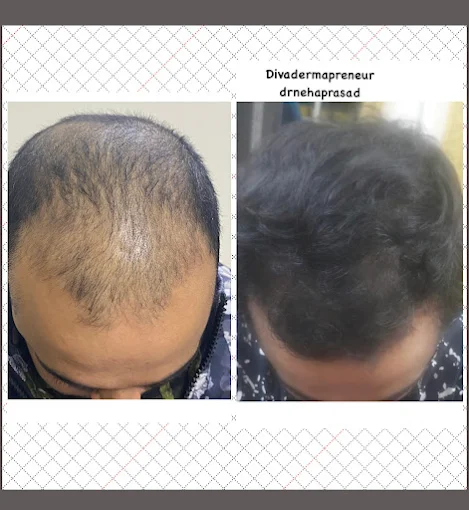 Dr. Neha Prasad Dermatologist