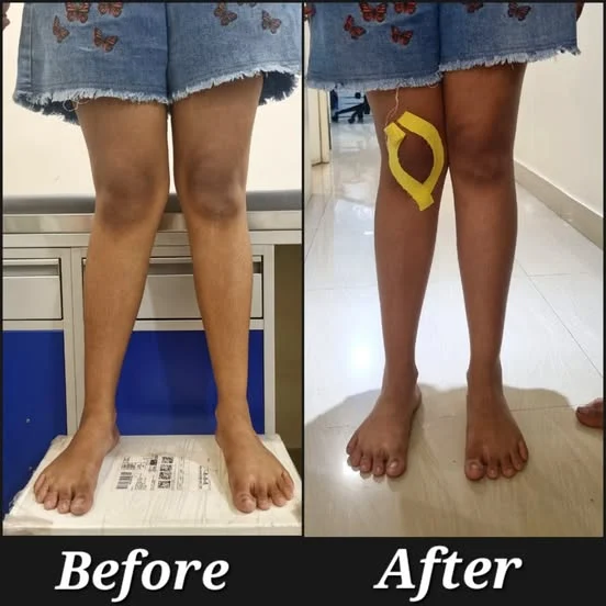 Acme Physiotherapy Centre