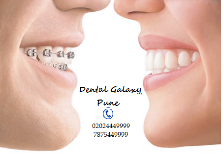 Dental Galaxy®