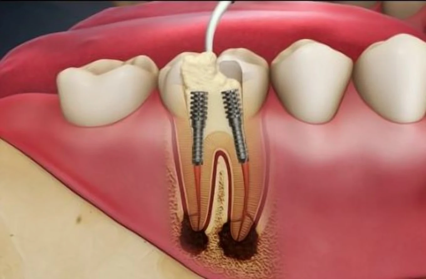 Acme Dental Lounge