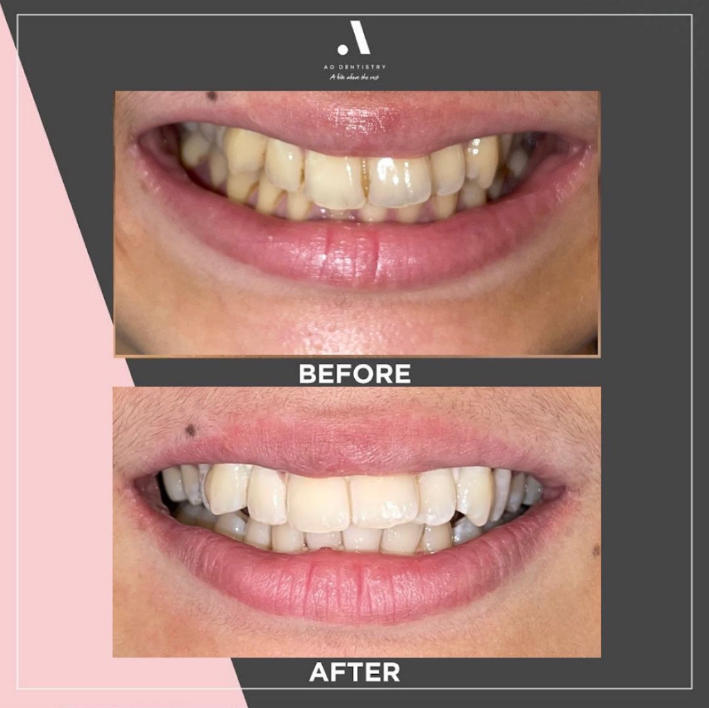 AO Dentistry