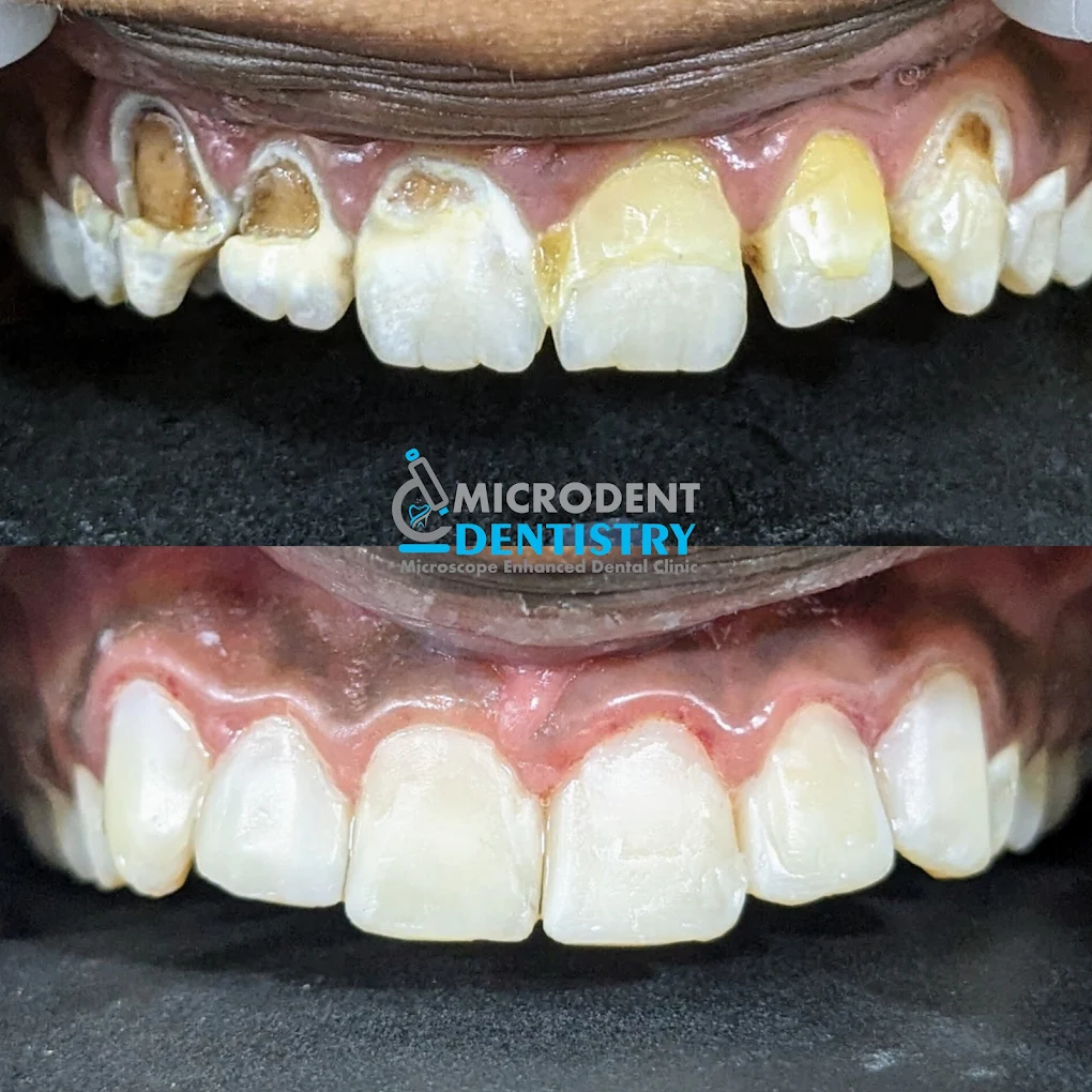 Microdent Dentistry Dental