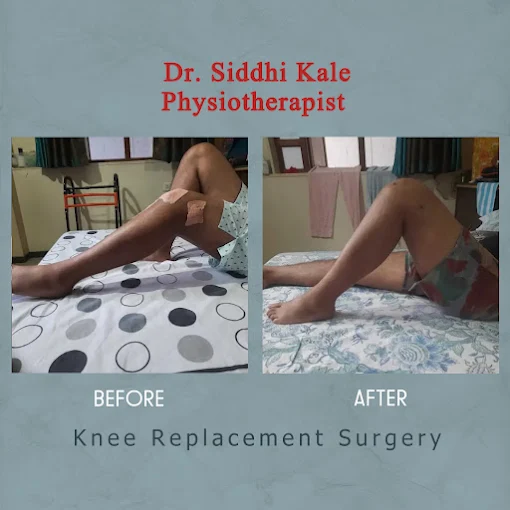 Dr.siddhi Kale - Physiotherapist