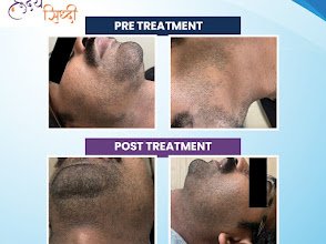 Dr Snehal Lunge Patil , Dermatologist