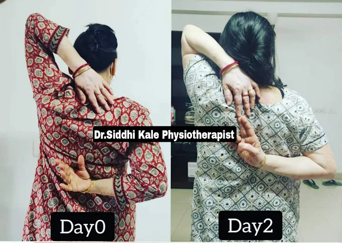 Dr.siddhi Kale - Physiotherapist